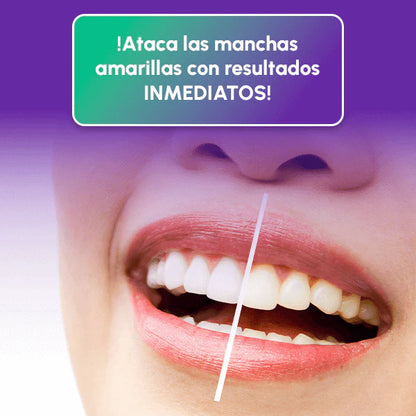 Dazzling White™ - Lápiz Blanqueador Profesional